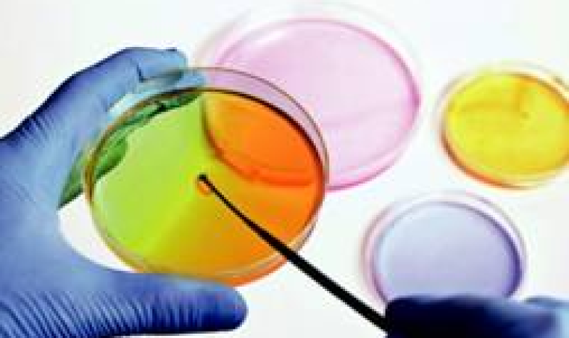 les-arees-de-microbiologia-i-bioquimica-de-l2019-lrc-acreditades-segons-la-norma-iso-15189.jpg
